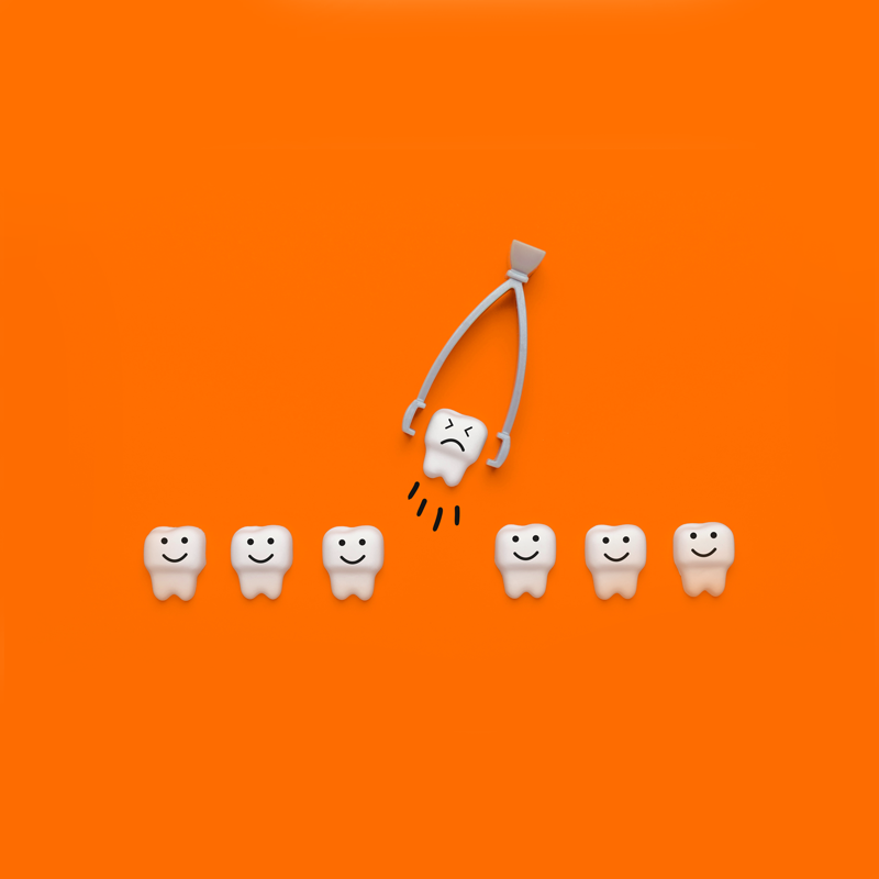 tooth-extractions-vivid-dental